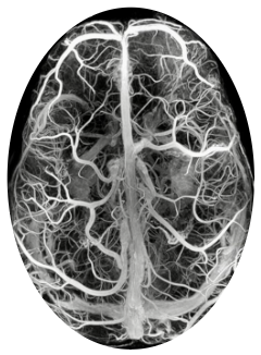 Neurons — human brain