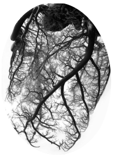 Vascular network — human heart